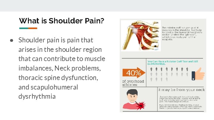 What is Shoulder Pain? ● Shoulder pain is pain that arises in the shoulder