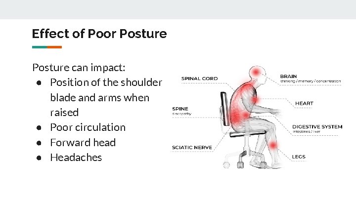 Effect of Poor Posture can impact: ● Position of the shoulder blade and arms