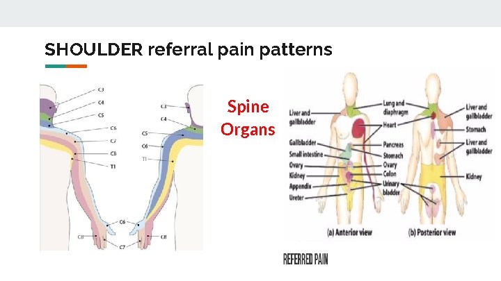 SHOULDER referral pain patterns Spine Organs 