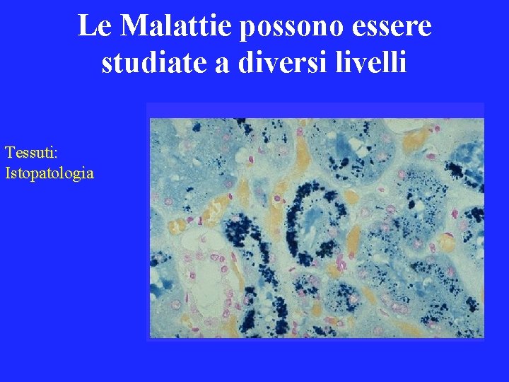 Le Malattie possono essere studiate a diversi livelli Tessuti: Istopatologia 