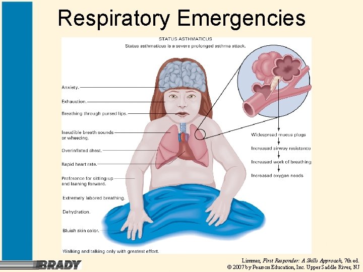 Respiratory Emergencies Limmer, First Responder: A Skills Approach, 7 th ed. © 2007 by
