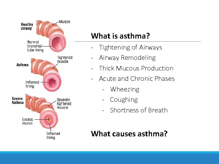 What is asthma? - Tightening of Airways Airway Remodeling Thick Mucous Production Acute and