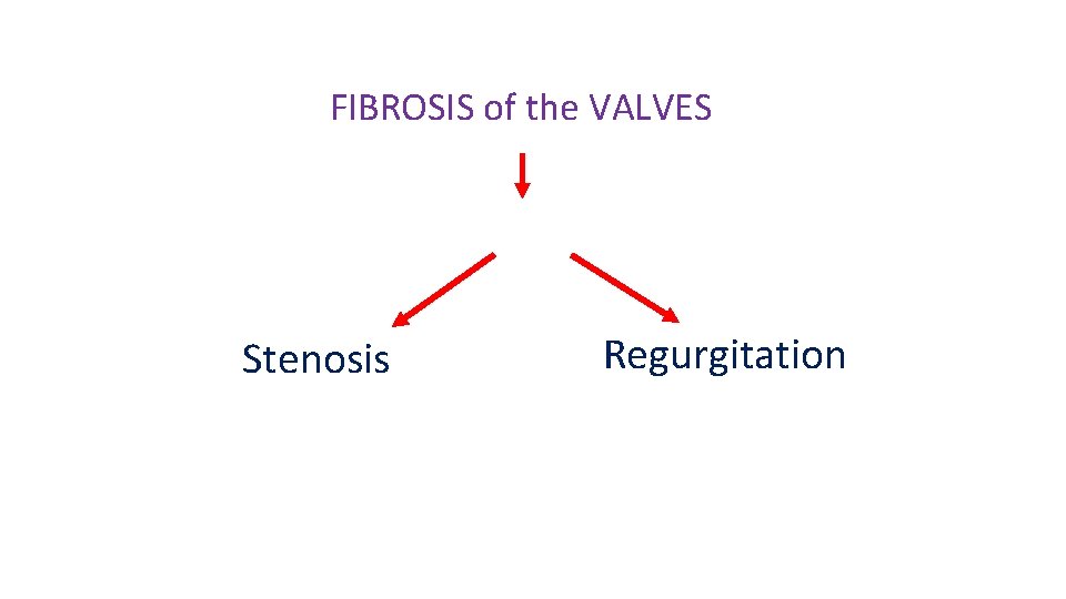 FIBROSIS of the VALVES Stenosis Regurgitation 