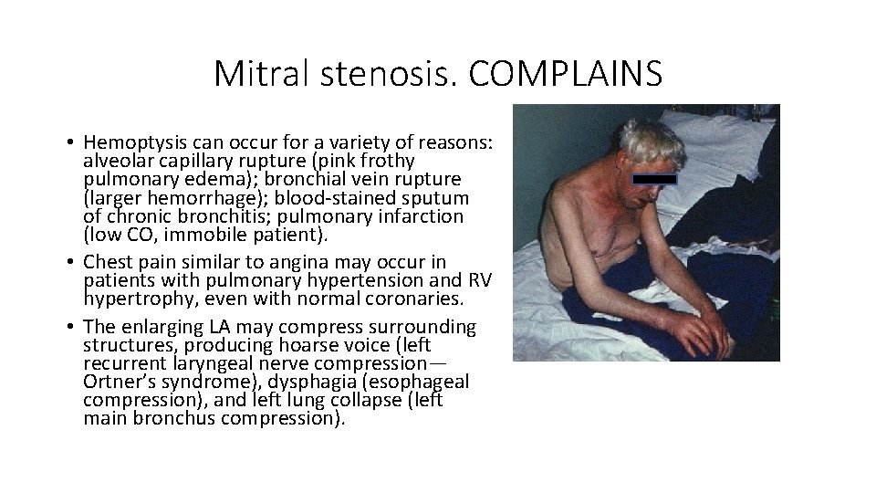 Mitral stenosis. COMPLAINS • Hemoptysis can occur for a variety of reasons: alveolar capillary