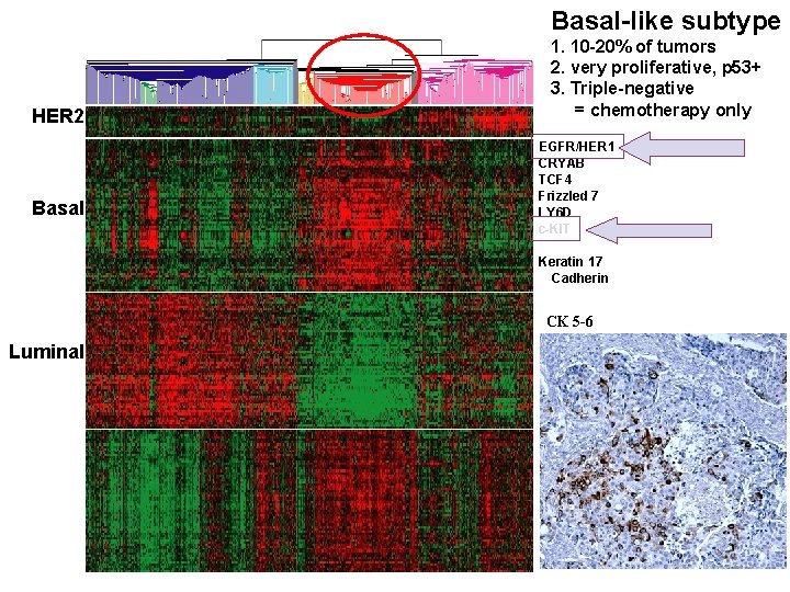 Basal-like subtype HER 2 Basal 1. 10 -20% of tumors 2. very proliferative, p