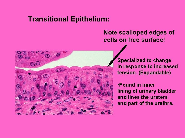 Transitional Epithelium: Note scalloped edges of cells on free surface! Specialized to change in
