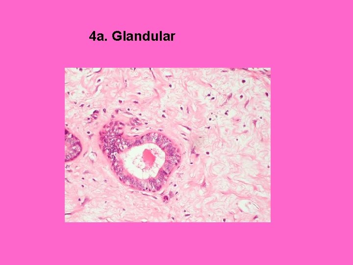 4 a. Glandular 