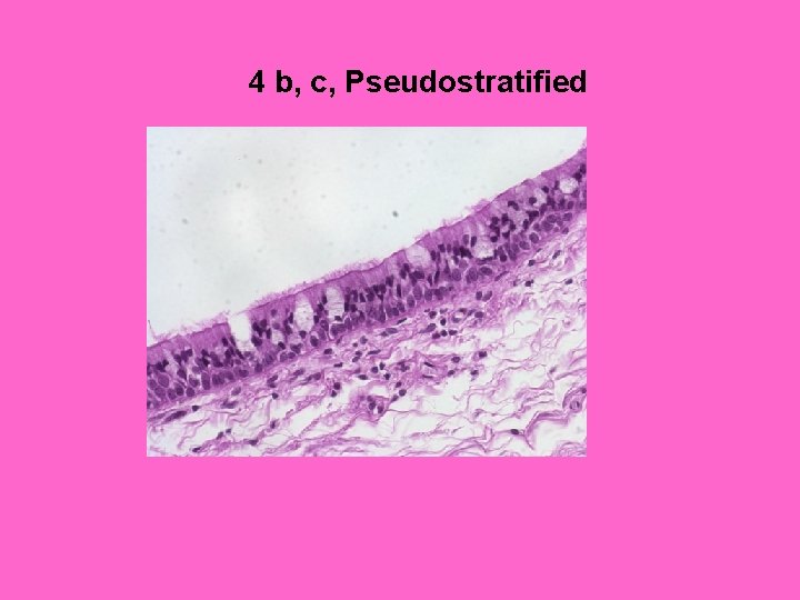 4 b, c, Pseudostratified 