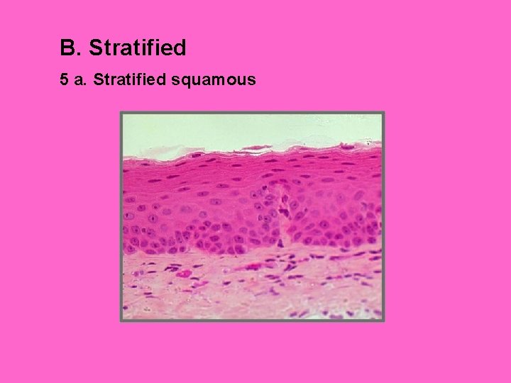 B. Stratified 5 a. Stratified squamous 