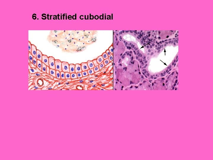 6. Stratified cubodial 