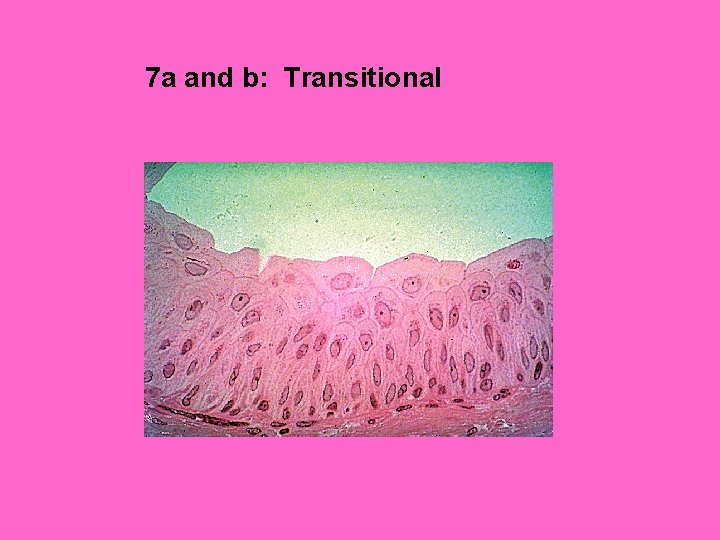 7 a and b: Transitional 