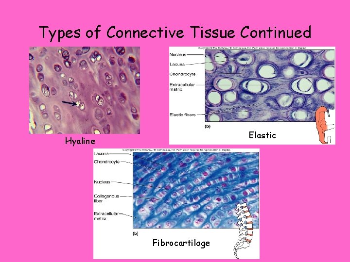 Types of Connective Tissue Continued Elastic Hyaline Fibrocartilage 