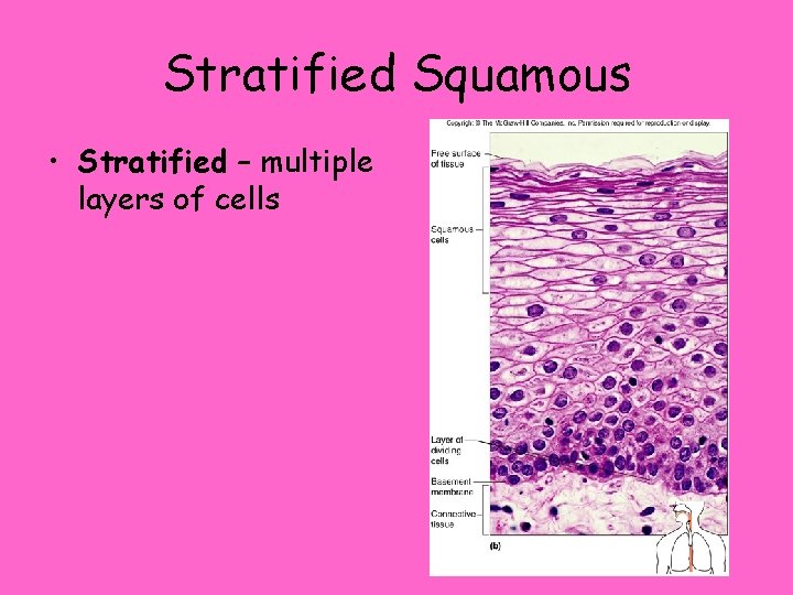 Stratified Squamous • Stratified – multiple layers of cells 
