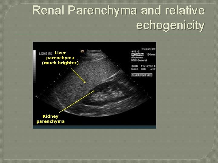 Renal Parenchyma and relative echogenicity 