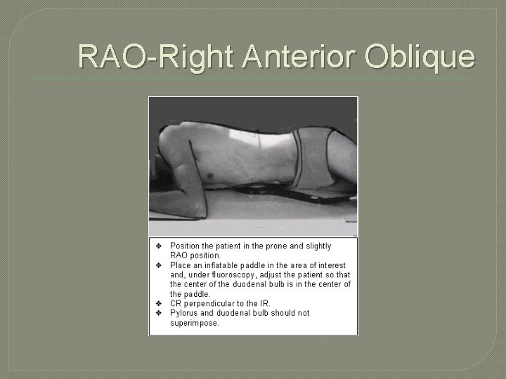 RAO-Right Anterior Oblique 