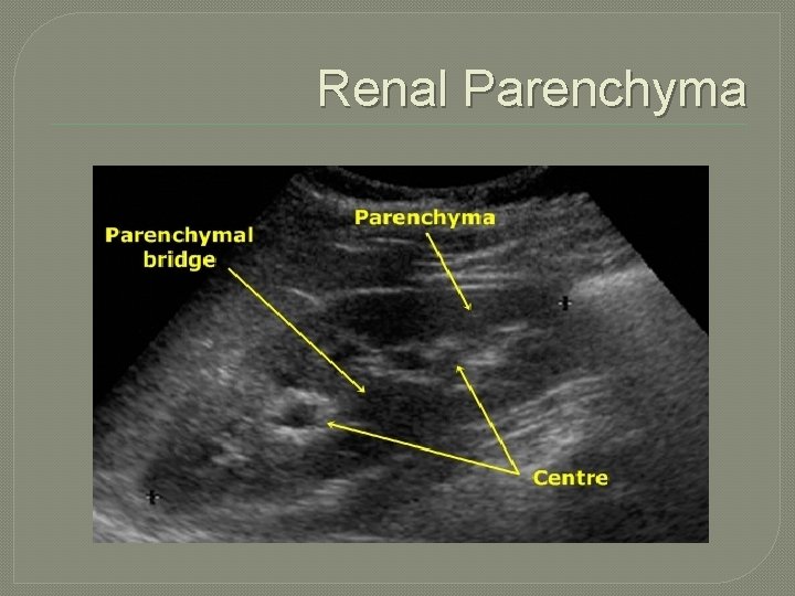 Renal Parenchyma 