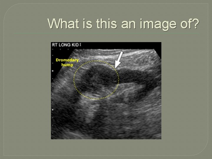 What is this an image of? 