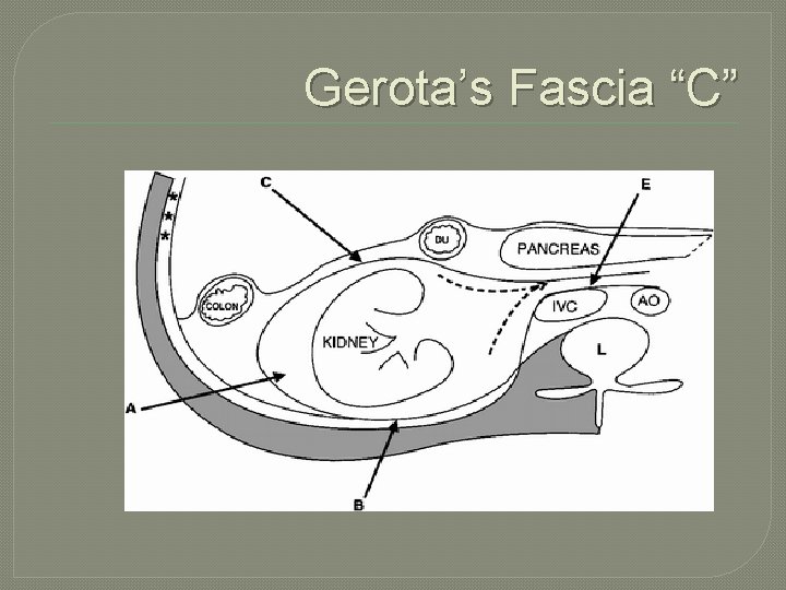 Gerota’s Fascia “C” 