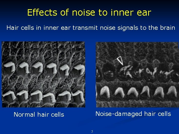 Effects of noise to inner ear Hair cells in inner ear transmit noise signals