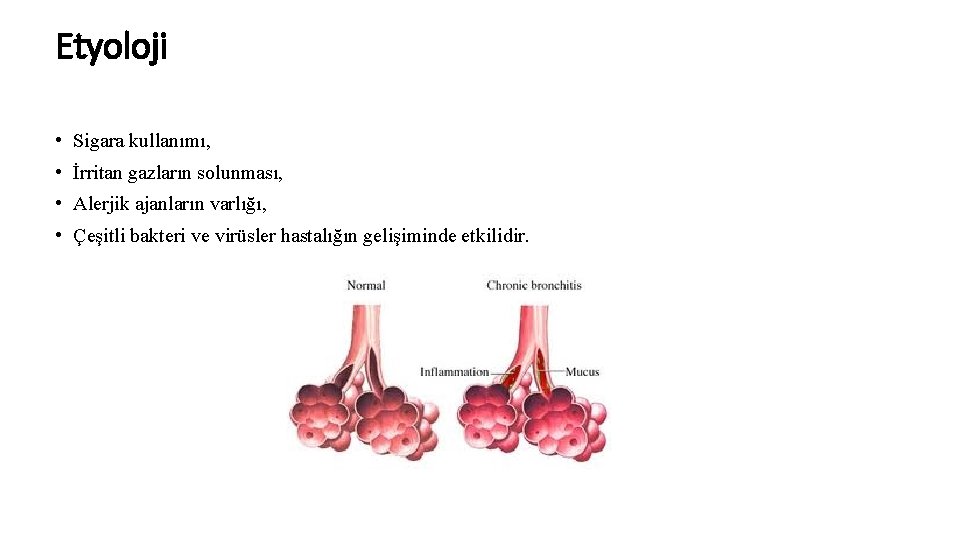 Etyoloji • Sigara kullanımı, • İrritan gazların solunması, • Alerjik ajanların varlığı, • Çeşitli