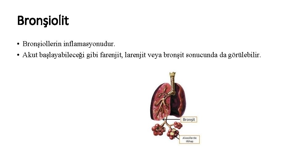 Bronşiolit • Bronşiollerin inflamasyonudur. • Akut başlayabileceği gibi farenjit, larenjit veya bronşit sonucunda da