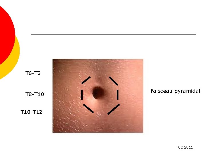 T 6 -T 8 T 8 -T 10 Faisceau pyramidal T 10 -T 12