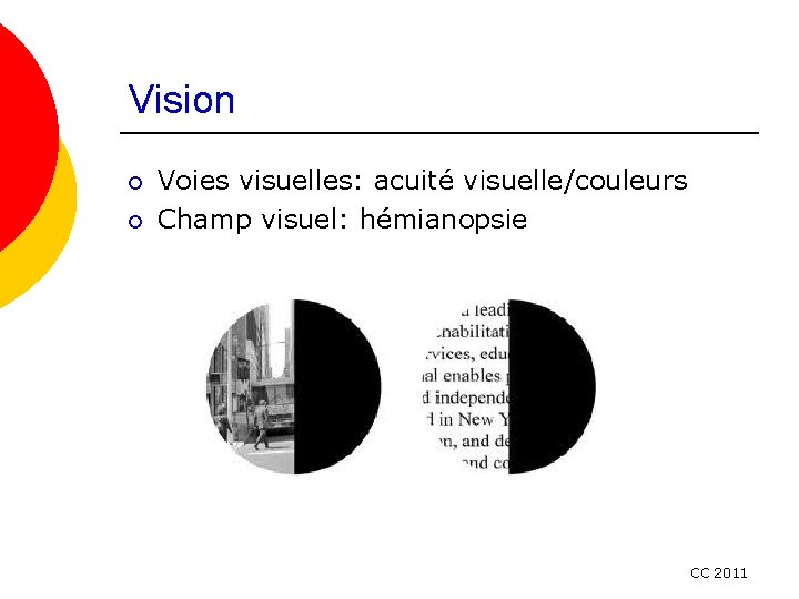 Vision ¡ ¡ Voies visuelles: acuité visuelle/couleurs Champ visuel: hémianopsie CC 2011 