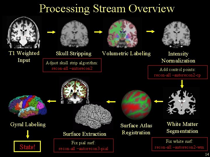 Processing Stream Overview T 1 Weighted Input Skull Stripping Volumetric Labeling Adjust skull strip