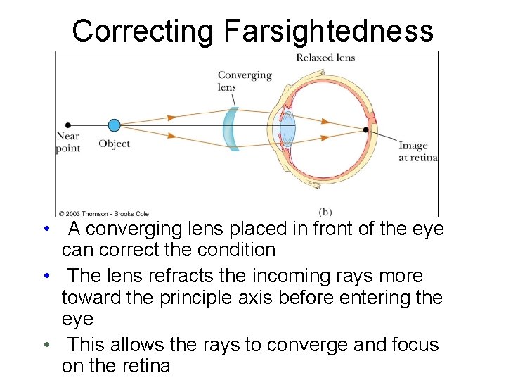 Correcting Farsightedness • A converging lens placed in front of the eye can correct