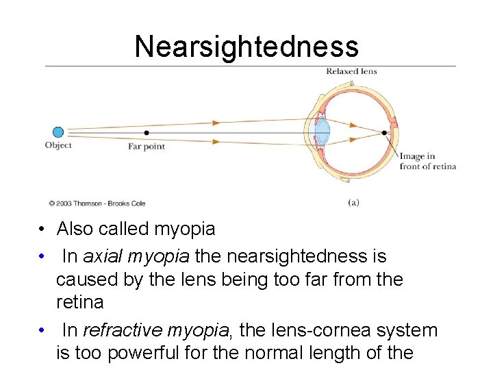 Nearsightedness • Also called myopia • In axial myopia the nearsightedness is caused by