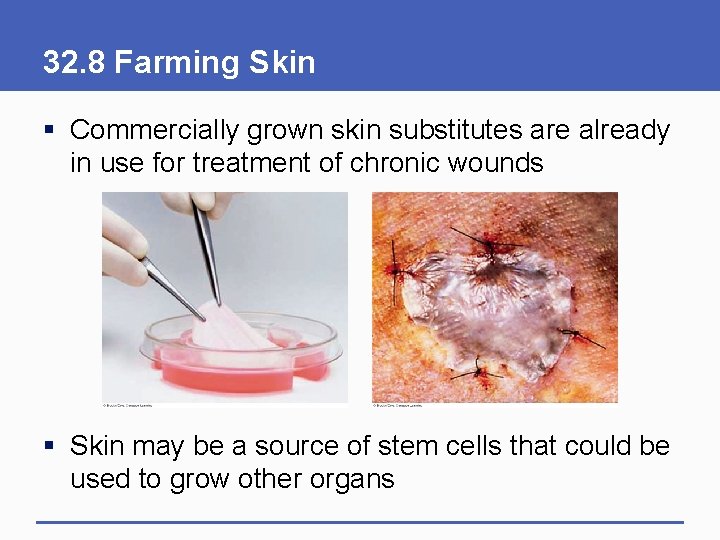 32. 8 Farming Skin § Commercially grown skin substitutes are already in use for