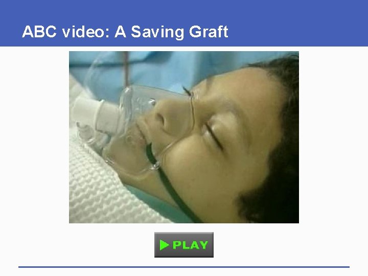 ABC video: A Saving Graft 