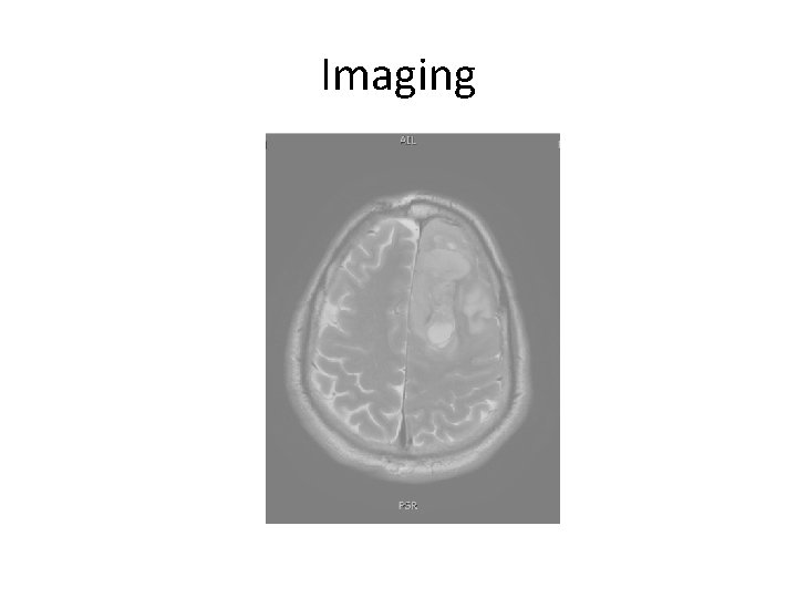 Imaging 