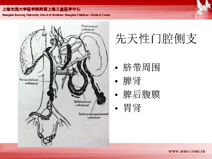 上海交通大学医学院附属上海儿童医学中心 Shanghai Jiaotong University School of Medicine Shanghai Children`s Medical Center 先天性门腔侧支 • •