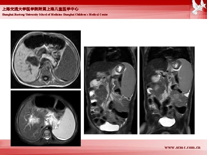 上海交通大学医学院附属上海儿童医学中心 Shanghai Jiaotong University School of Medicine Shanghai Children`s Medical Center www. scmc. com.