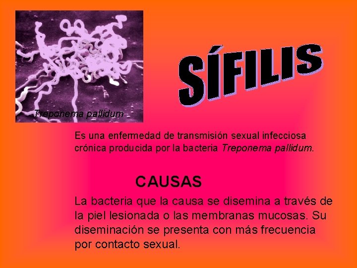 Treponema pallidum Es una enfermedad de transmisión sexual infecciosa crónica producida por la bacteria
