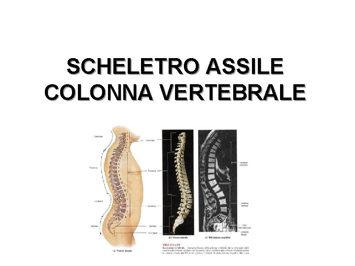 SCHELETRO ASSILE COLONNA VERTEBRALE 