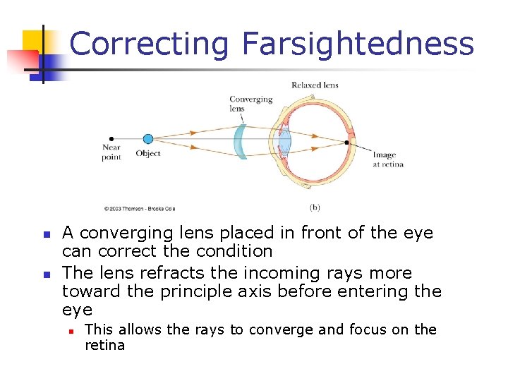 Correcting Farsightedness n n A converging lens placed in front of the eye can