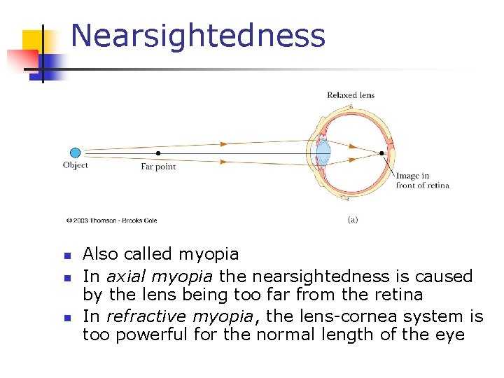 Nearsightedness n n n Also called myopia In axial myopia the nearsightedness is caused