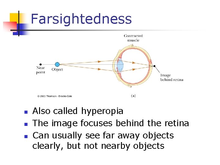 Farsightedness n n n Also called hyperopia The image focuses behind the retina Can