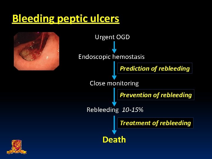 Bleeding peptic ulcers Urgent OGD Endoscopic hemostasis Prediction of rebleeding Close monitoring Prevention of
