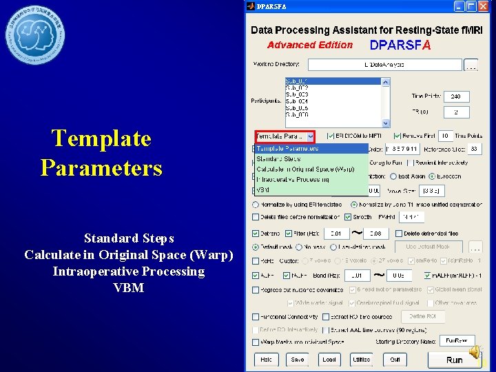 Template Parameters Standard Steps Calculate in Original Space (Warp) Intraoperative Processing VBM 10 