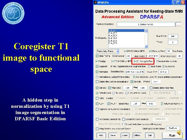 Coregister T 1 image to functional space A hidden step in normalization by using
