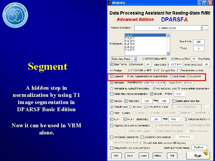 Segment A hidden step in normalization by using T 1 image segmentation in DPARSF