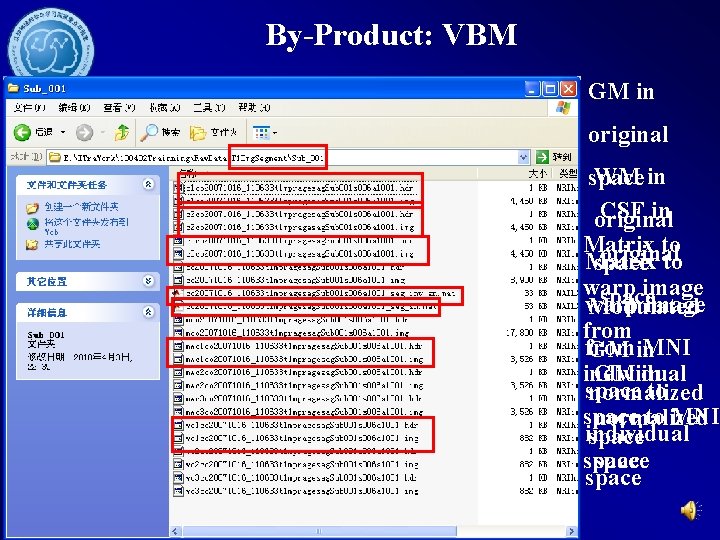 By-Product: VBM GM in original WM in space CSF in original Matrix to original