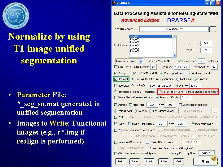 Normalize by using T 1 image unified segmentation • Parameter File: *_seg_sn. mat generated