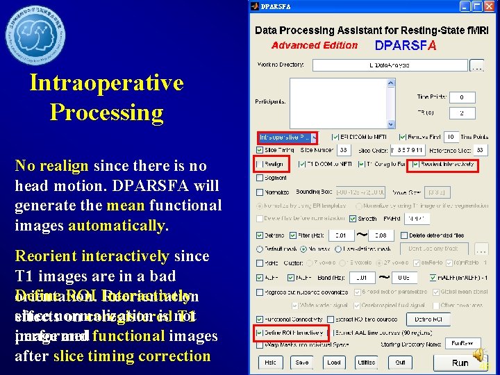 Intraoperative Processing No realign since there is no head motion. DPARSFA will generate the