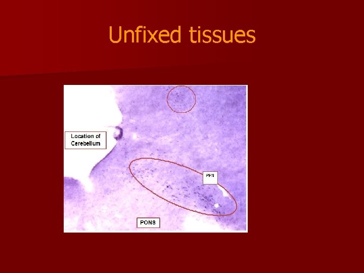 Unfixed tissues 