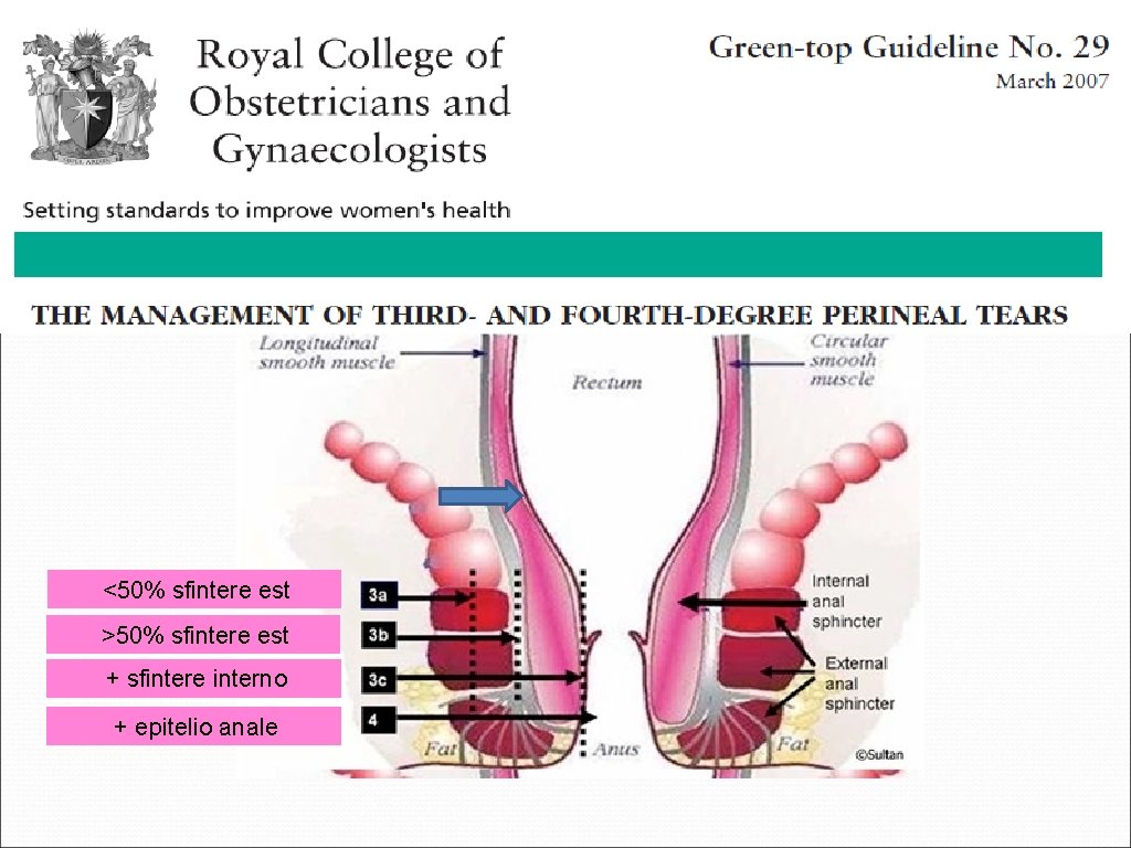 <50% sfintere est >50% sfintere est + sfintere interno + epitelio anale 