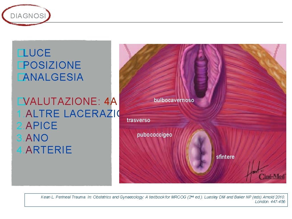 DIAGNOSI �LUCE �POSIZIONE �ANALGESIA bulbocavernoso �VALUTAZIONE: 4 A 1. ALTRE LACERAZIONI trasverso 2. APICE